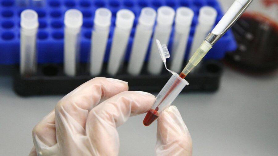 hiv testi 2313212 yP0Eic