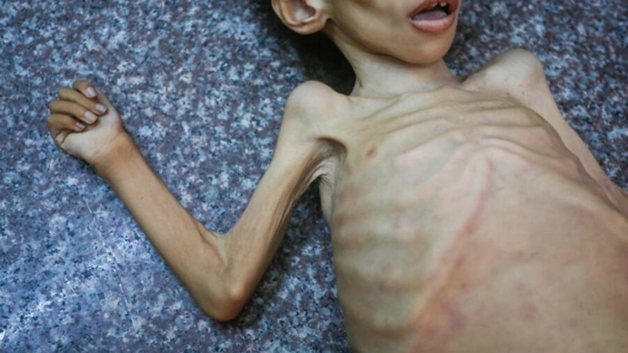 UNRWA: İsrail’in Gazze’de Filistinlilere havadan yardım atma planı açlığı engellemeyecek gazze aa 2381871 ZgaiIV